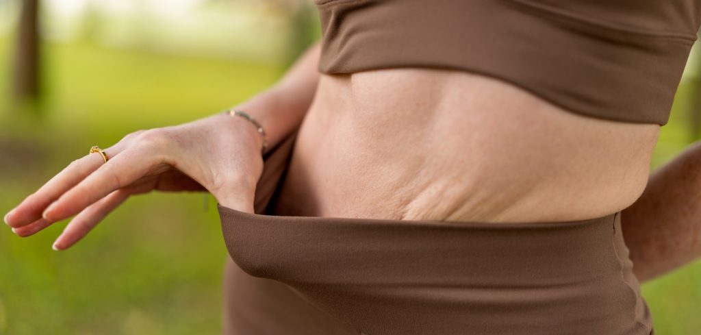How Lower Body Lift Surgery Removes Excess Skin and Transforms Your Silhouette