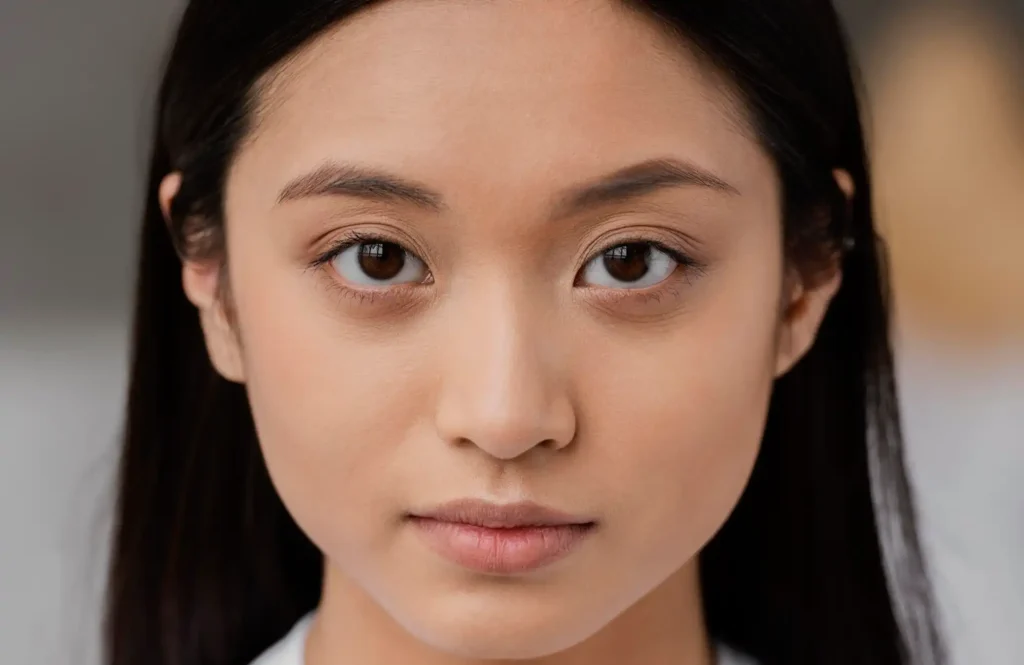 How Asian Eyelid Surgery Can Transform Your Look Safely